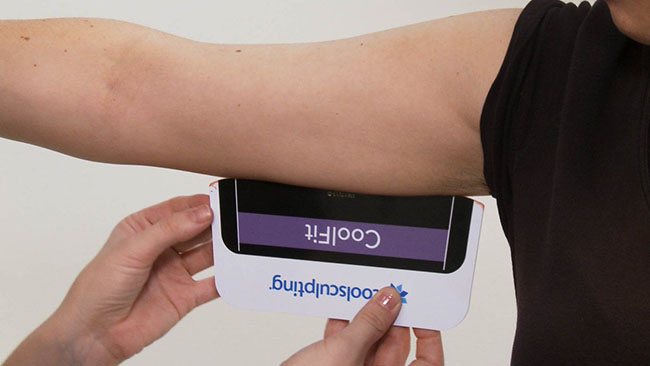 Coolsculpting