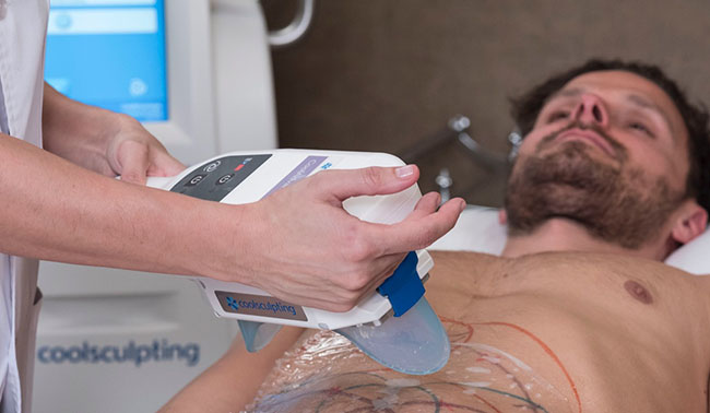 Coolsculpting